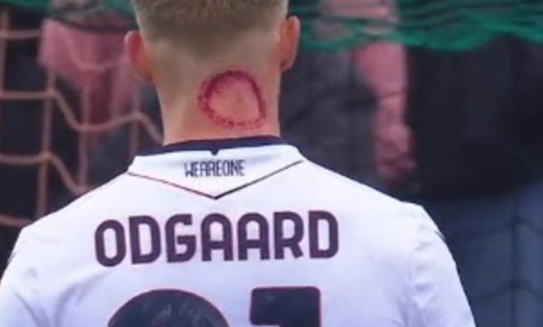 Serie A Star Responds to Viral ‘Zombie Bite’ Injury!